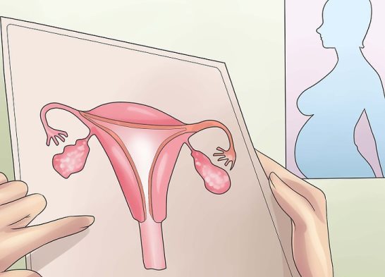 беременность при СПКЯ