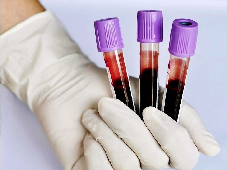 Общий и биохимический анализ крови