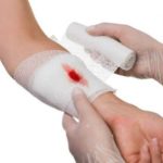 Окончание обработки раны на руке