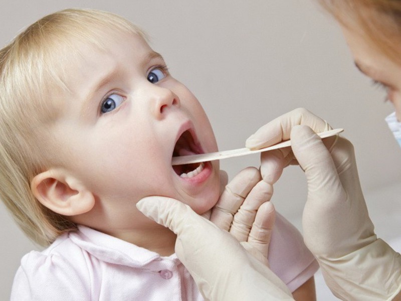 Обработка полости рта ребенку. Осмотр полости рта у детей. Осмотр полости рта и миндалин у детей.