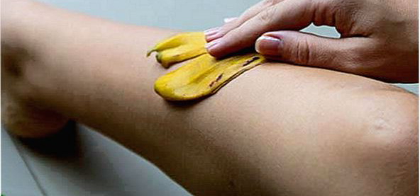 кожура банана как средство против синяков