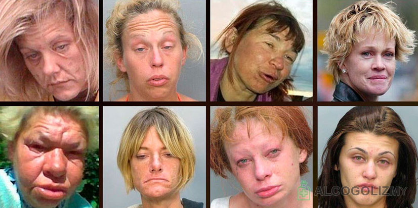 Признаки алкоголизма у женщин на лице по фото