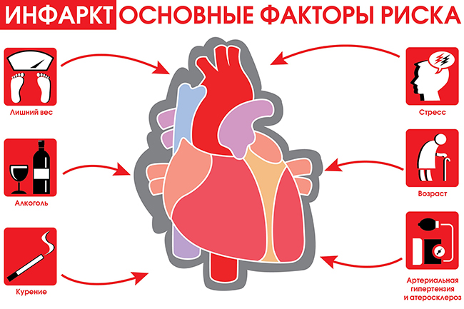 Причины развития инфаркта миокарда