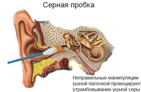 воспаление уха