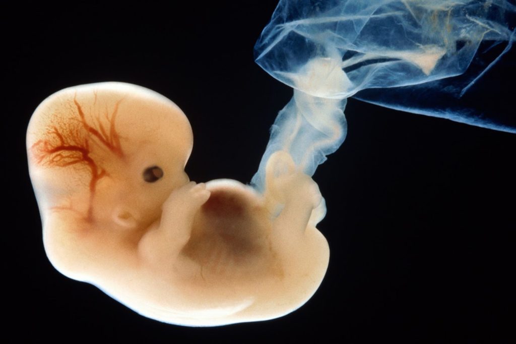 Как выглядит ребенок в 6 недель беременности внутри утробе матери фото