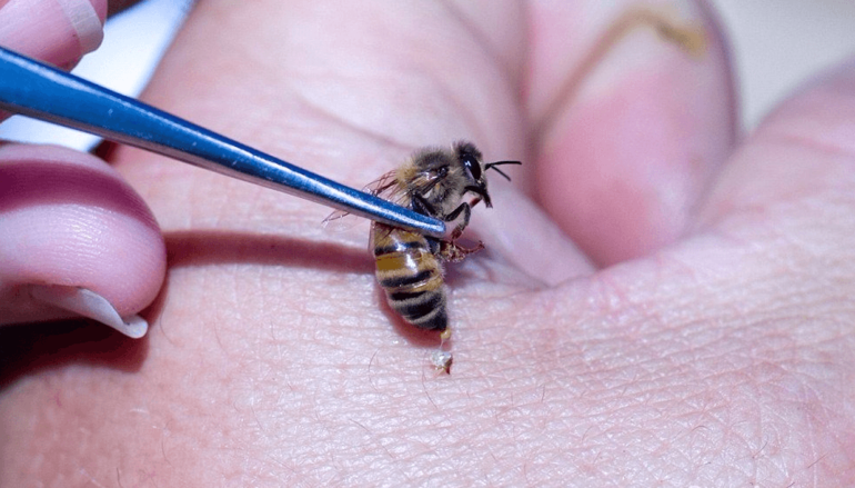 Лечение пчелами вред и польза
