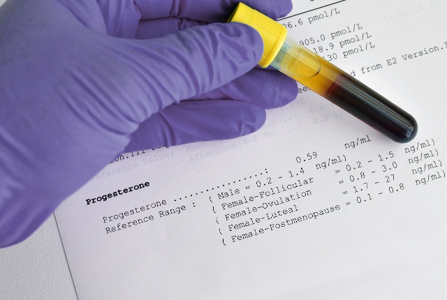 анализ крови на прогестерон