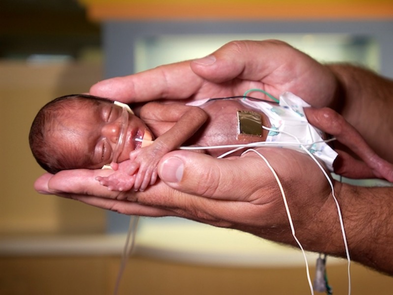 Недоношенные новорожденные, особенности ухода