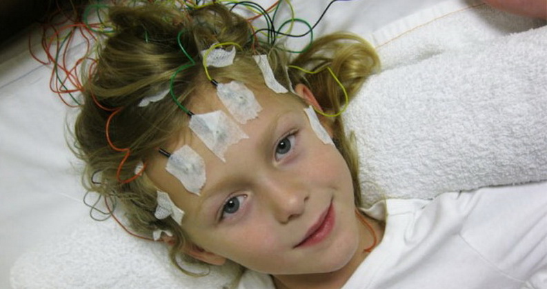Признаки эпилепсии у детей