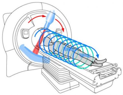 компьютерная томография фото