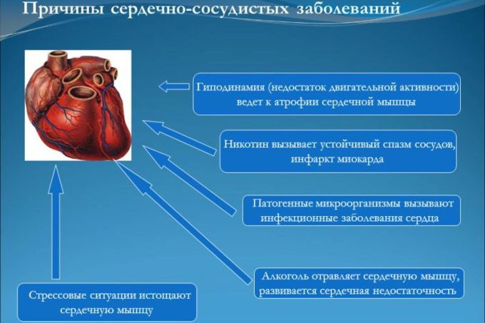 Причины болезни сердца